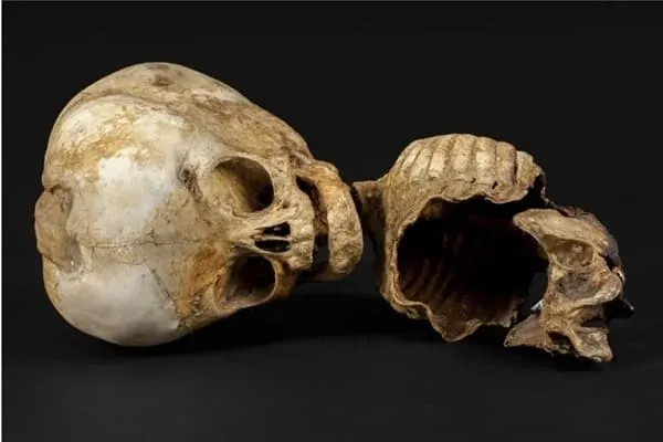 esqueleto-de-feto-de-museo-de-antropologia-forense-ucm-madrid
