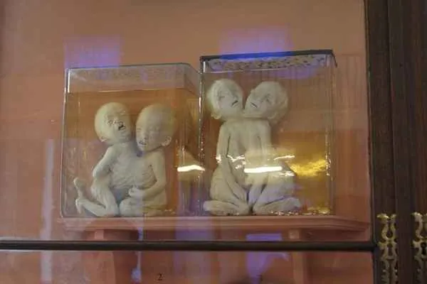 museo kunstkamera san petersburgo