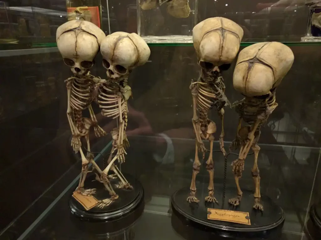 Serie de cráneos con diferentes patologías, parte del estudio de enfermedades en el Museo Vrolik